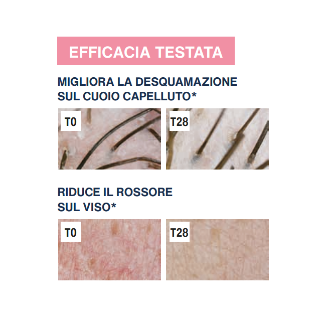 Rilastil Difesa Dermatite Seborroica Gel Lenitivo Sebonormalizzante 30 Ml Rilastil Difesa Dermatite Seborroica Gel Lenitivo Sebonormalizzante 30 Ml