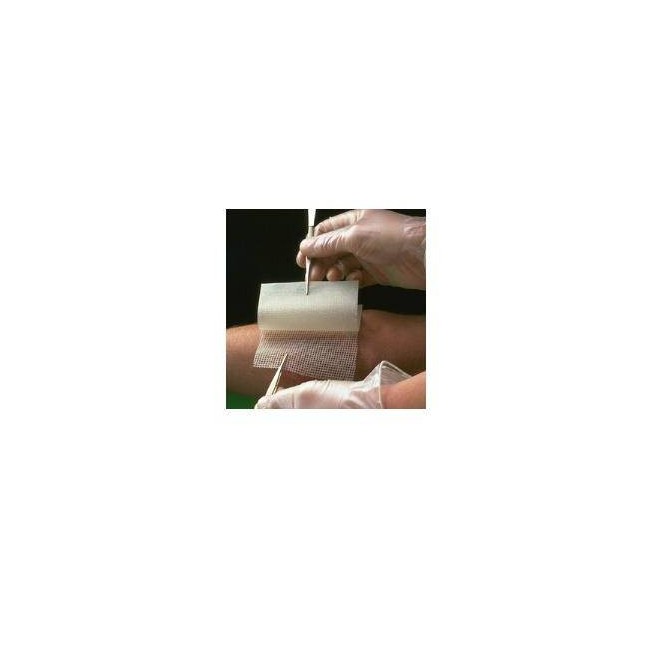 Garza Medicata Bactigras Con Clorexidina Acetato 0,5% 10x10cm 10 Pezzi