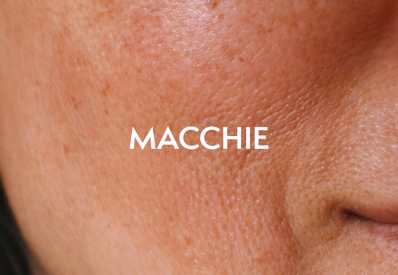 Rientro dalle ferie e cura della pelle Rientro dalle ferie e cura della pelle